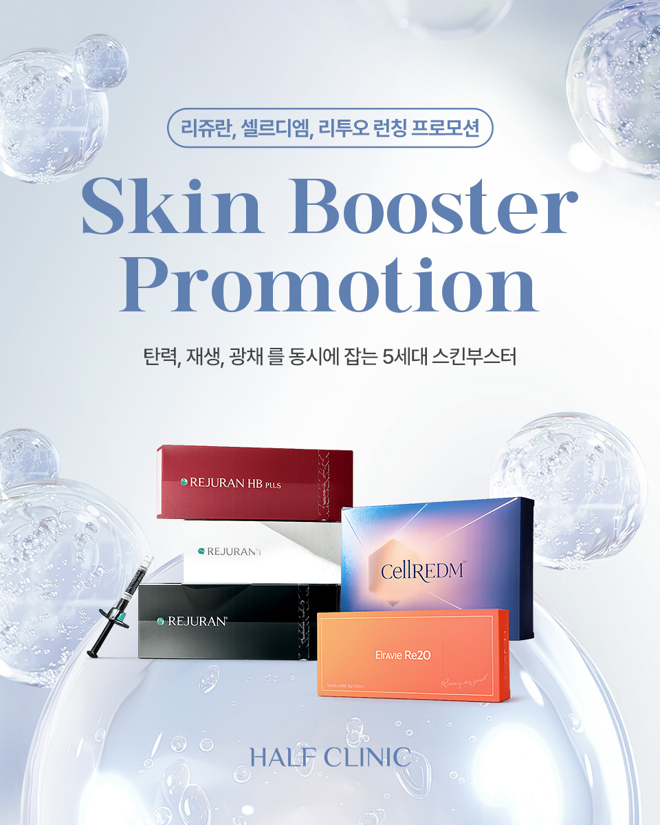 모바일